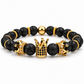 Marble Crown Bracelets